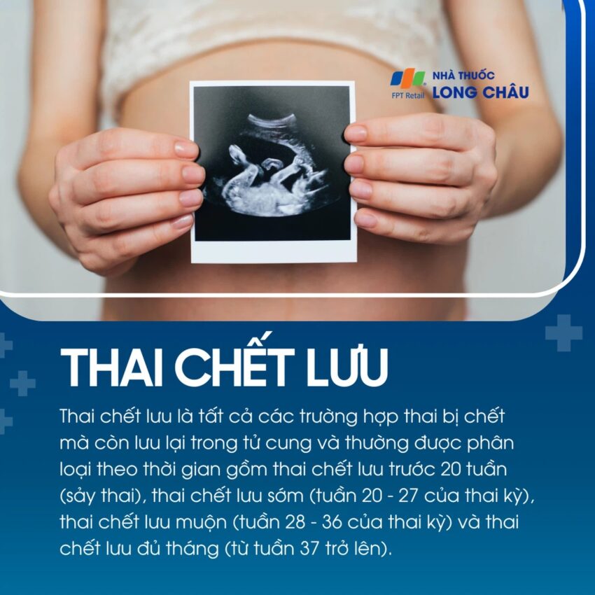thai lưu là sao