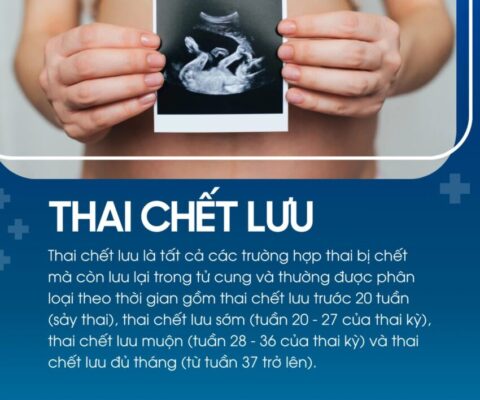 Thai lưu: Định nghĩa, Nguyên nhân, Dấu hiệu và Cách xử lý 99 thai chết lưu là gì