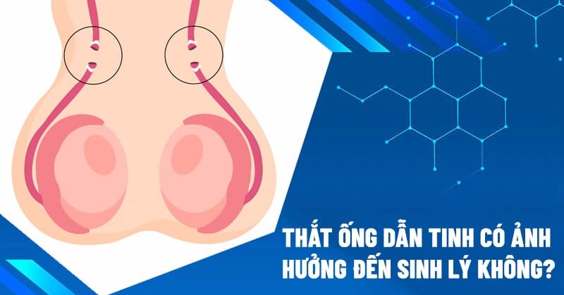 Thắt ống dẫn tinh
