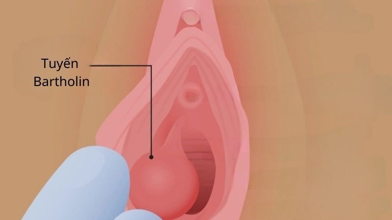 Phụ nữ ra nhiều chất nhờn khi quan hệ: Thông tin, Nguyên nhân, Phân loại và Tác động 2 tuyến Bartholin