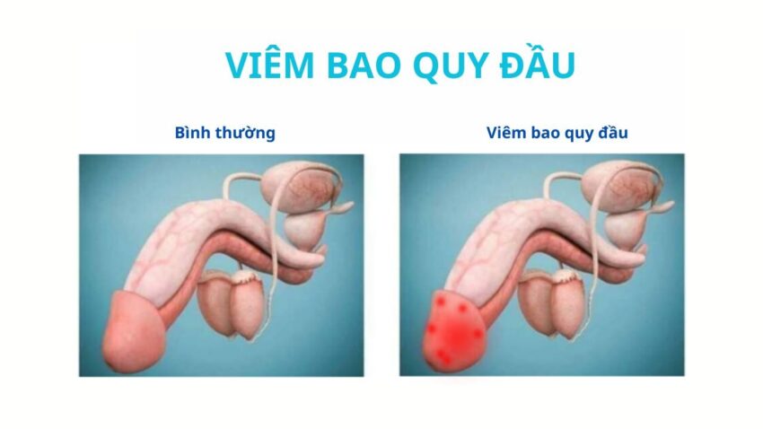 Khi Nào Cần Đi Khám