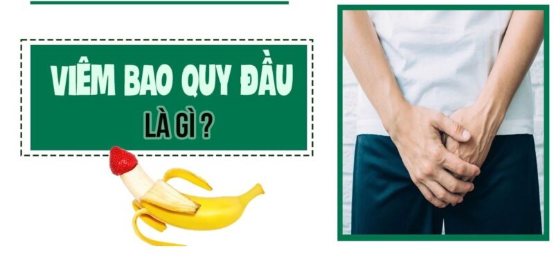 viêm bao quy đầu cấp tính