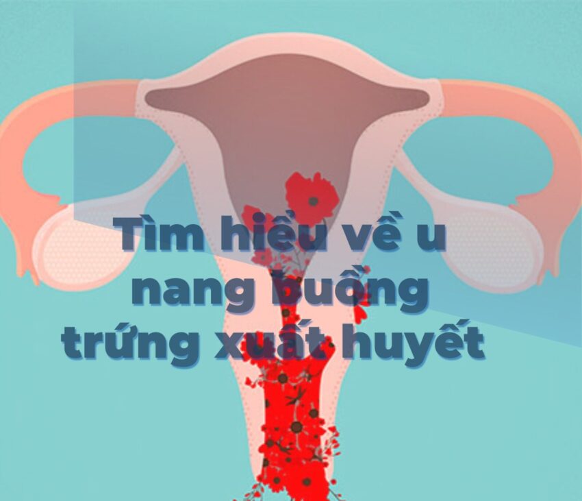 xuất huyết nang buồng trứng có thai không