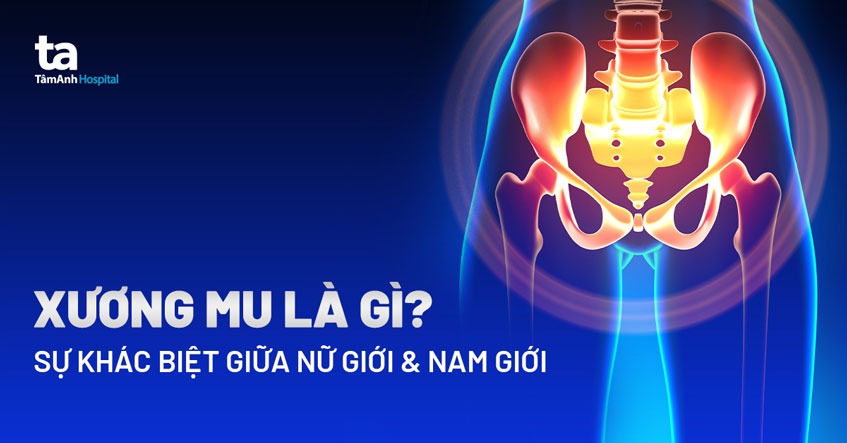 xương mu nhô cao