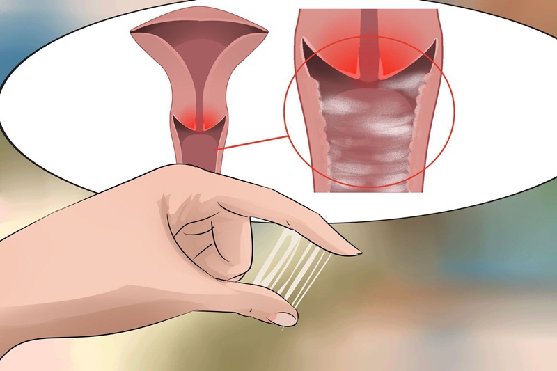 Dịch tiết màu xám