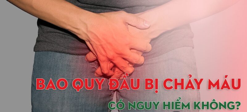 Bao Quy Đầu Bị Chảy Máu: Nguyên Nhân, Dấu Hiệu, Cách Xử Lý và Phòng Ngừa 88 bao quy đầu bị chảy máu