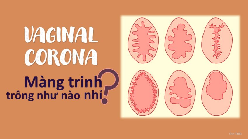 Cấu Tạo Của Màng Trinh