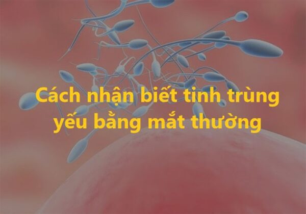 cách nhận biết tinh trùng yếu