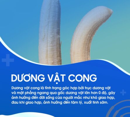 bài tập cho cậu nhỏ bị cong