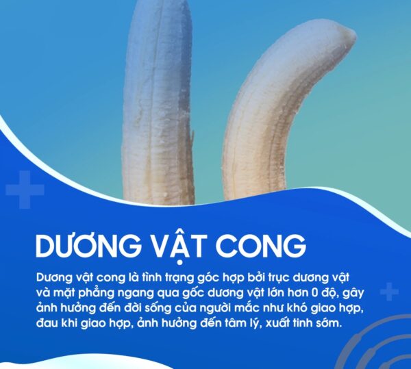 bài tập cho cậu nhỏ bị cong