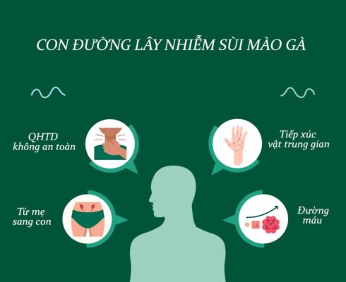 sùi mào gà lây qua đường nào