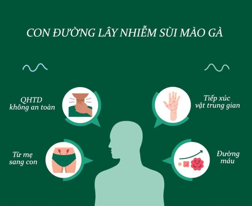 sùi mào gà lây qua đường nào