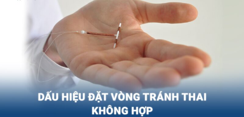 Dấu Hiệu Đặt Vòng Không Hợp: Nguyên Nhân, Biến Chứng và Cách Xử Lý An Toàn 193 dấu hiệu đặt vòng không hợp