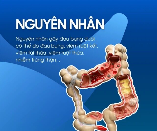 Những Nguyên Nhân