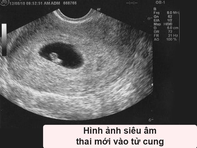 Cuộc Chơi Của Cảm Xúc Và Sự Đồng Hành