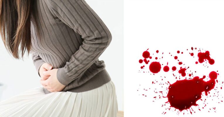 Đặt vòng chống dính buồng tử cung: Thông tin, Tác dụng, Quy trình và Lưu ý chi phí 4 Gây sảy thai