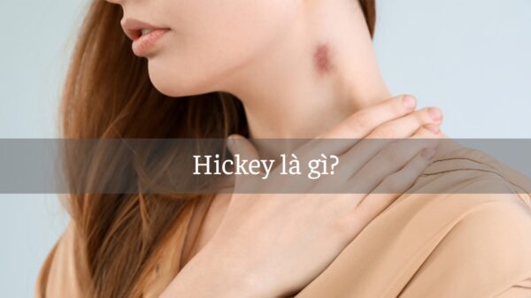cách hickey phê