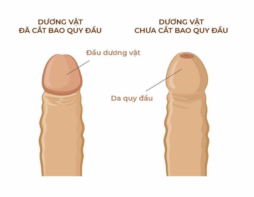 Có và không có