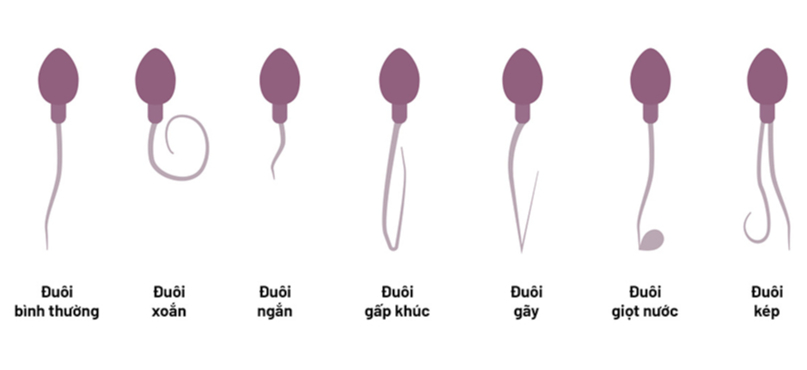 Kiêng quan hệ bao lâu để tinh trùng khỏe: Thông tin, Yếu tố ảnh hưởng và Khuyến nghị Y khoa 3 Hình thái tinh trùng