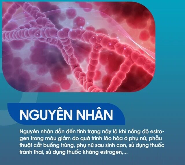 Những Nguyên Nhân