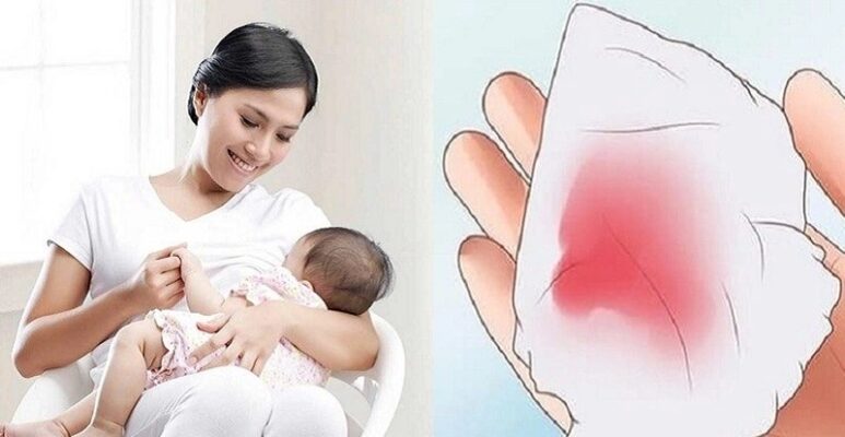 kinh nguyệt sau sinh có màu gì