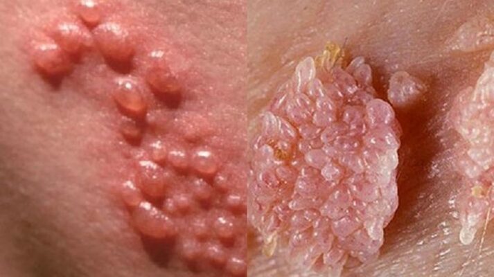 Vừa hết kinh quan hệ có sao không