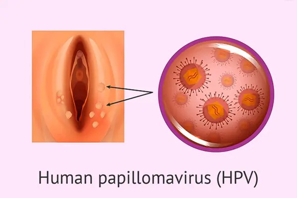 Phân biệt mụn thường và bệnh lý