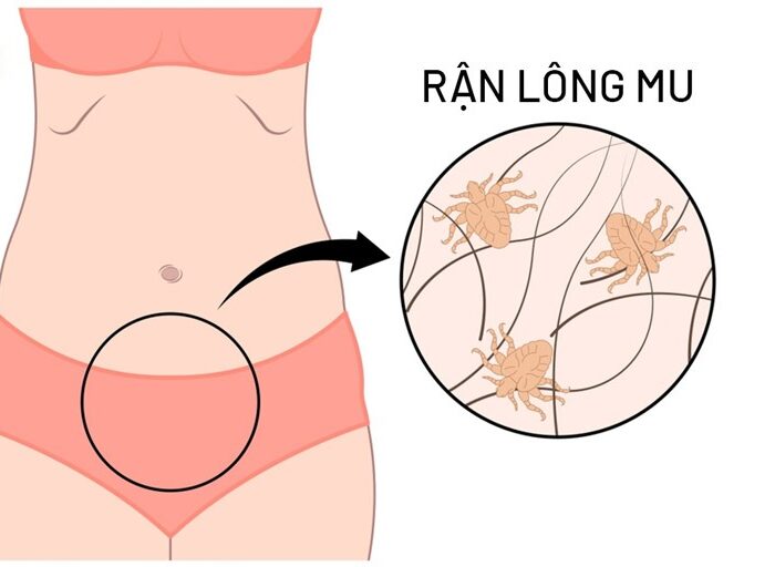 Thủ Phạm" Giấu Mặt