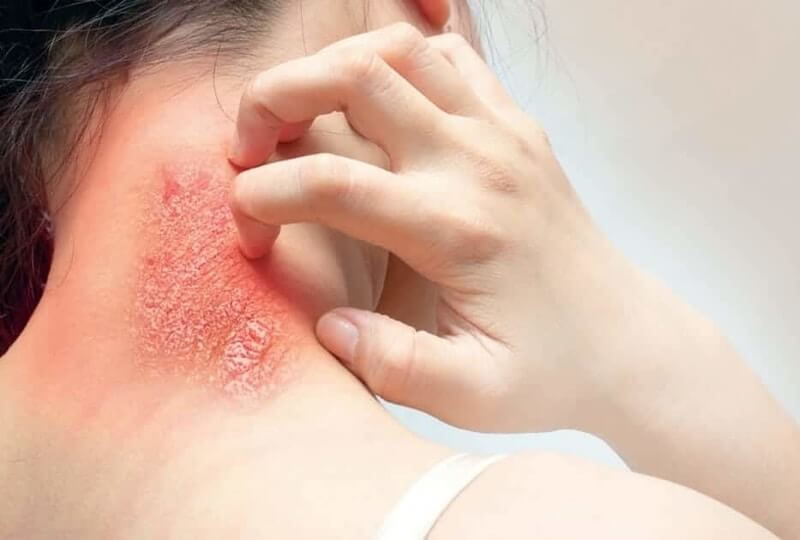 nhiễm trùng da