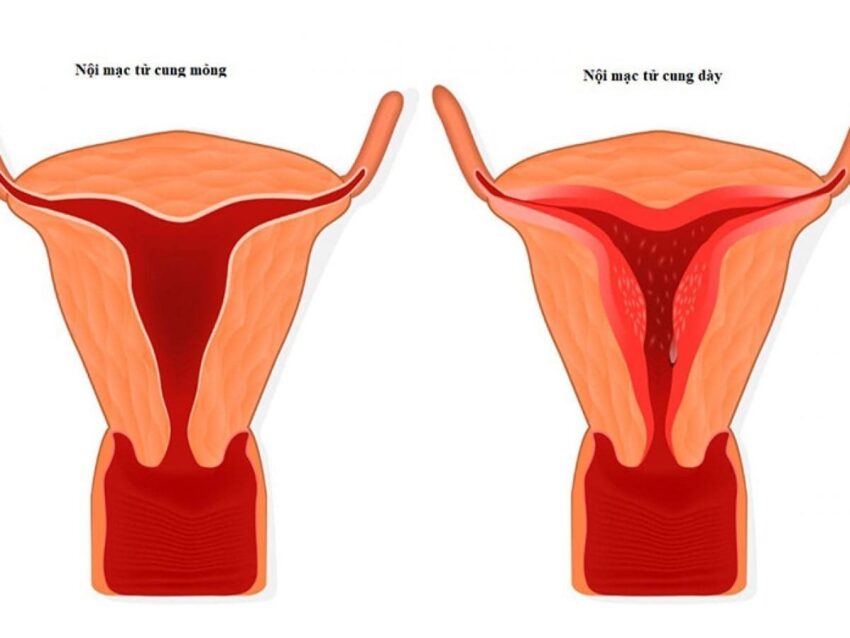 Không Đủ Vững Chắc
