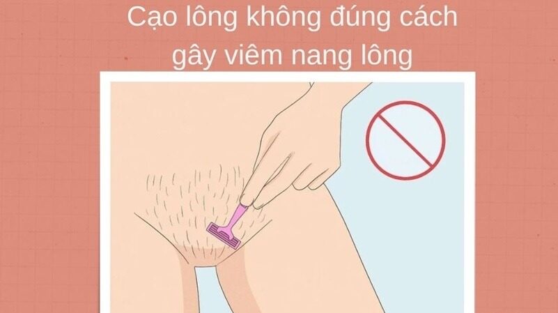 Nguồn Gốc