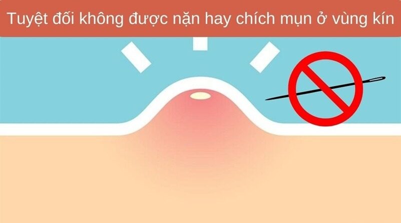 Có Nên Nặn
