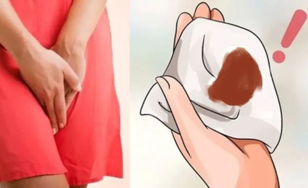 Quan hệ xong ra dịch nâu
