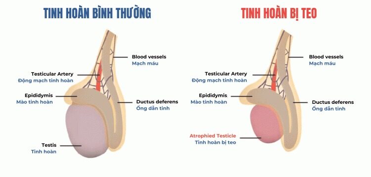 teo tinh hoan co chua duoc khong e1759895853277