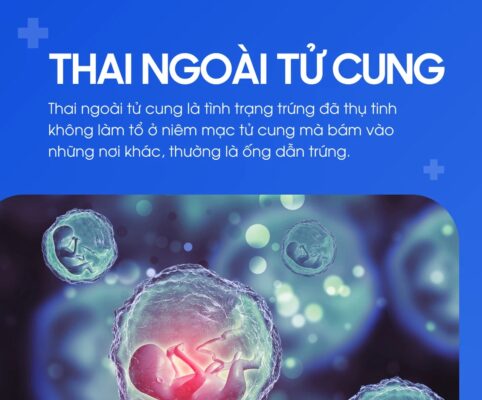 thai ngoai tu cung e1752119307355