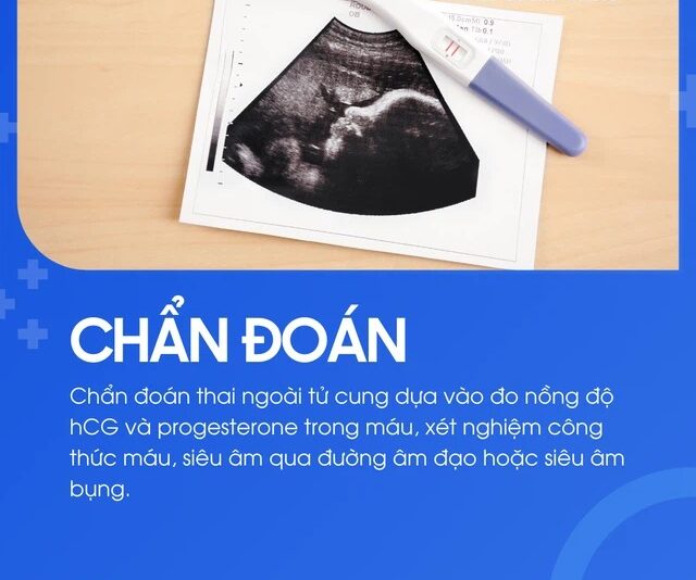 Chẩn Đoán