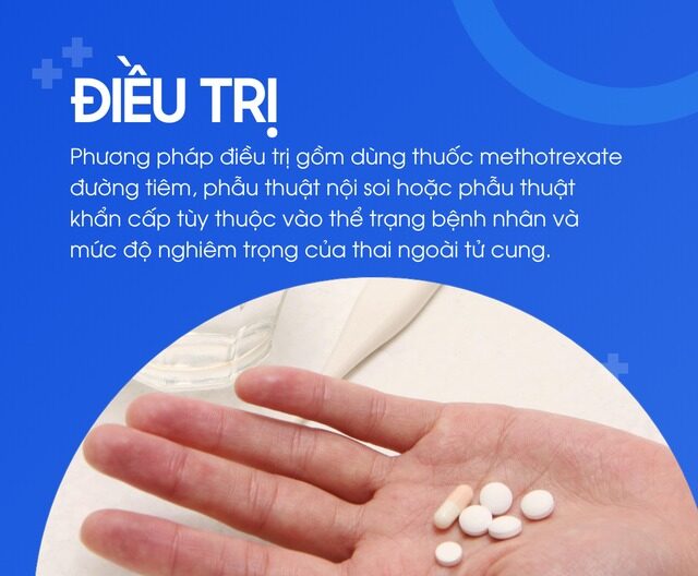 Phương Pháp Xử Lý