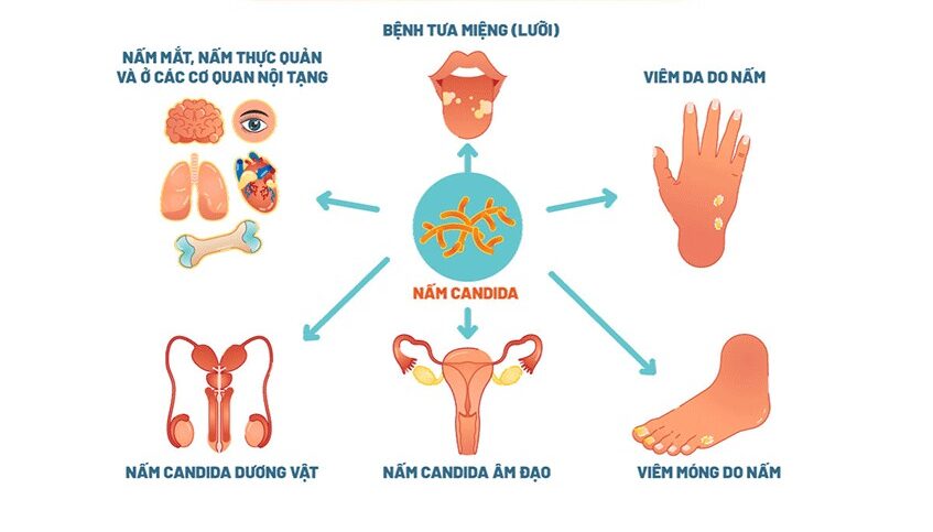 Dấu Hiệu Nhận Biết