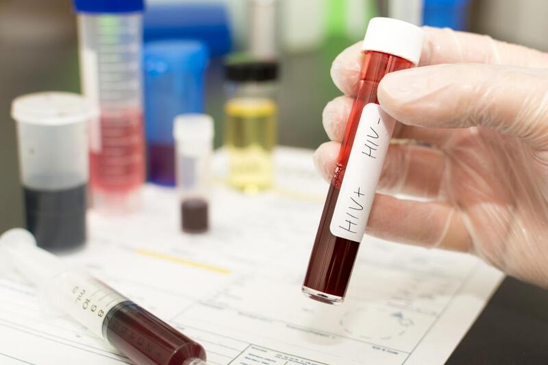 Xác suất lây nhiễm HIV sau 1 lần quan hệ: Thông tin, Tỷ lệ, Yếu tố ảnh hưởng và Cách phòng ngừa 8 Xét nghiệm axit nucleic (NAT)