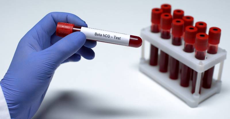 Beta HCG
