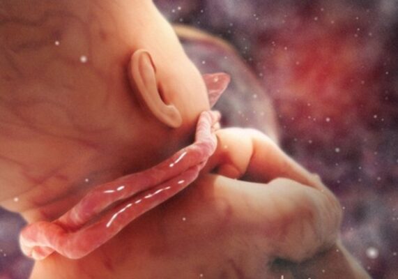 Thai chết lưu: Định nghĩa, Nguyên nhân, Dấu hiệu và Can thiệp y khoa 13 Thai chết lưu