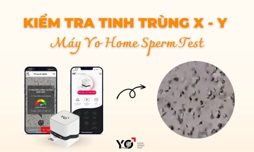 cách nhận biết tinh trùng X và Y