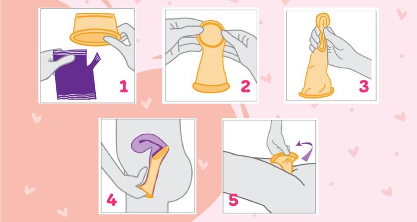Hướng Dẫn Chi Tiết Cách Sử Dụng Bao Cao Su Nữ