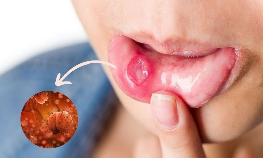 Quan hệ tình dục bằng miệng