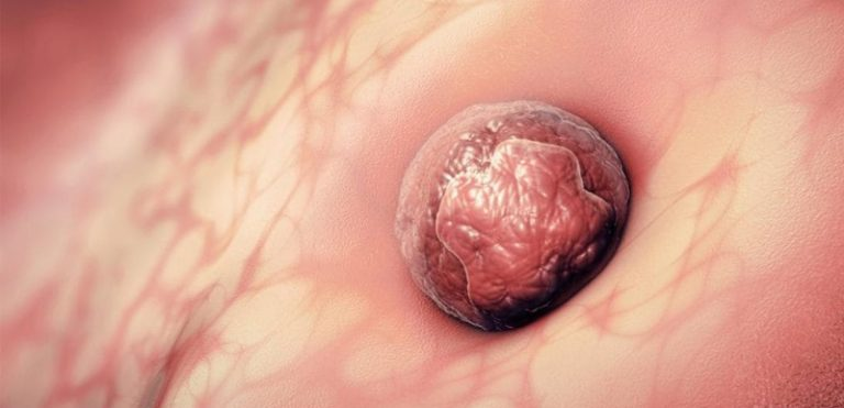 Thai 5 Tuần Chưa Có Phôi: Thông Tin Y Khoa, Nguyên Nhân, Dấu Hiệu và Hướng Xử Lý 2 Kích thước túi thai