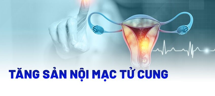 tăng sinh nội mạc tử cung