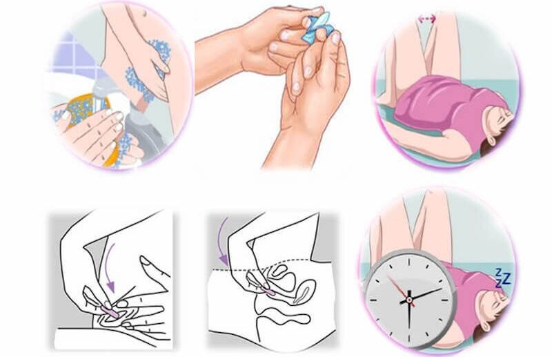 vừa quan hệ xong có đặt thuốc được không