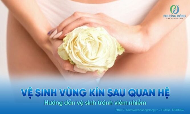 vệ sinh sau quan hệ