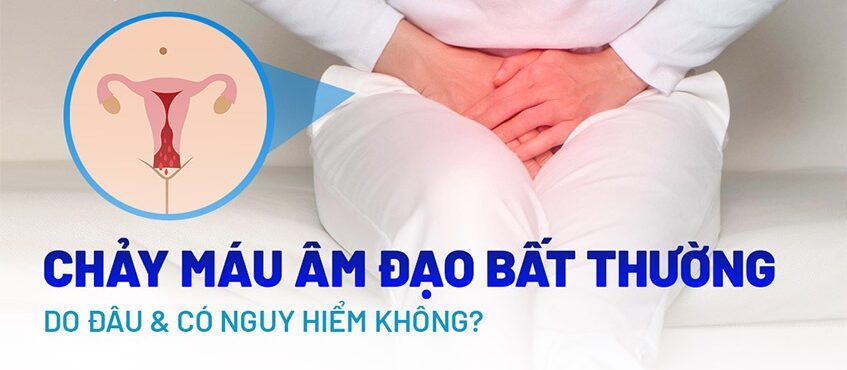 chảy máu vùng kín
