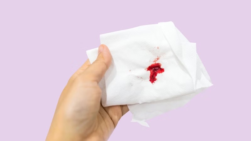 chảy máu vùng kín